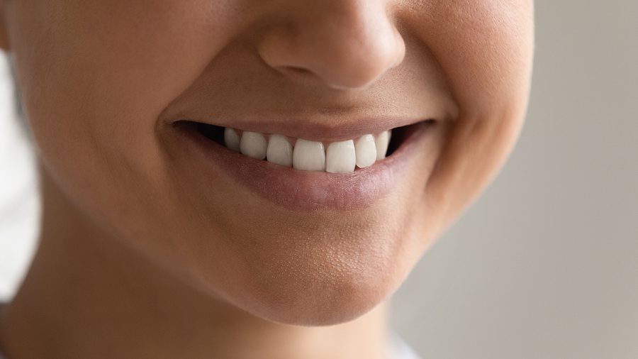 Close up of a smiling female who is happy with recent dental procedure.